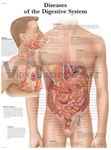 Diseases of Digestive System - Anatomical Chart